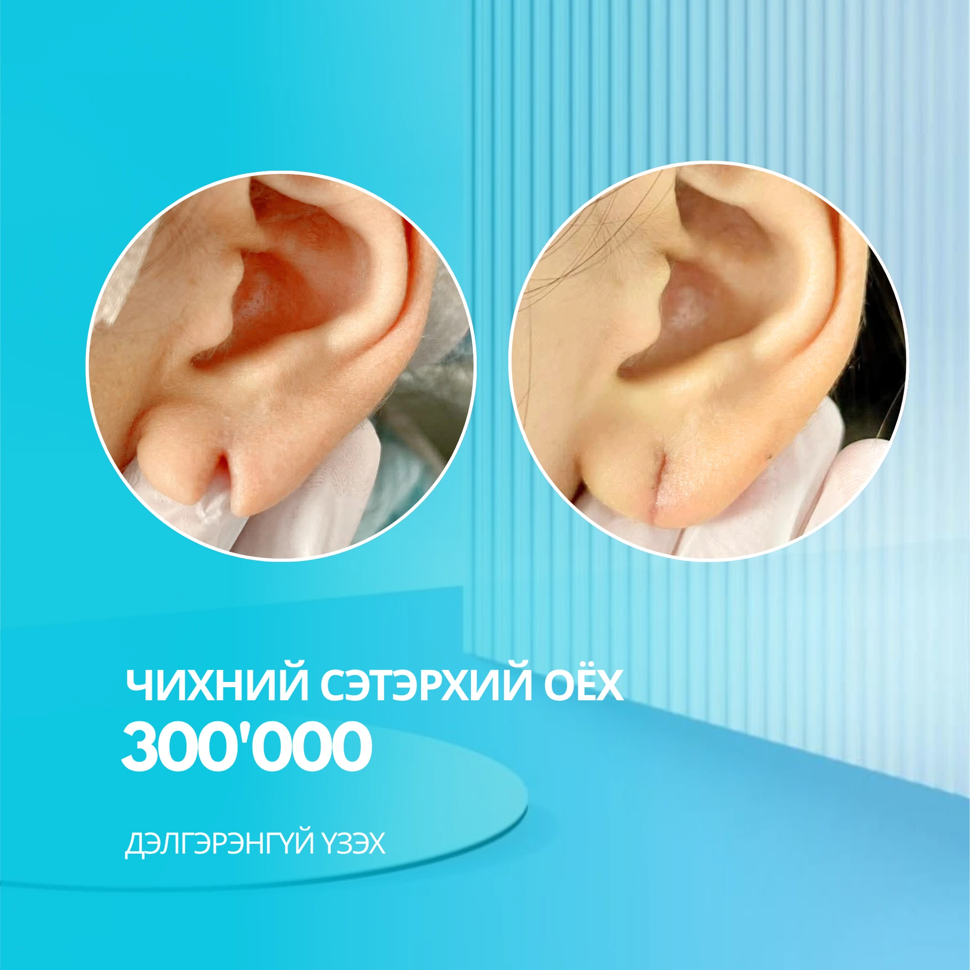 Чихний сэтэрхий оёх